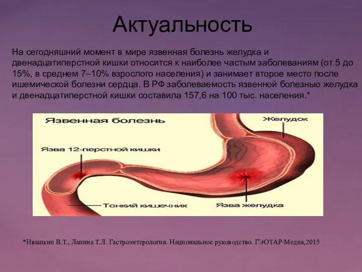 Актуальность На сегодняшний момент в мире язвенная болезнь желудка и