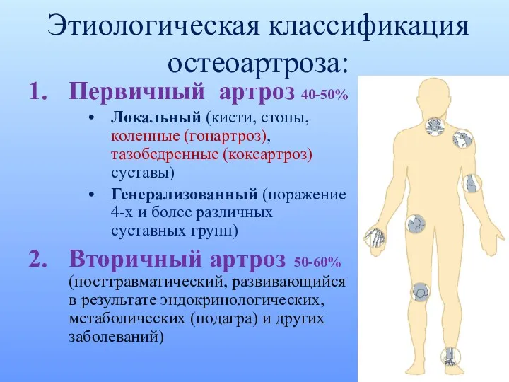 Этиологическая классификация остеоартроза: Первичный артроз 40-50% Локальный (кисти, стопы, коленные (гонартроз), тазобедренные (коксартроз)