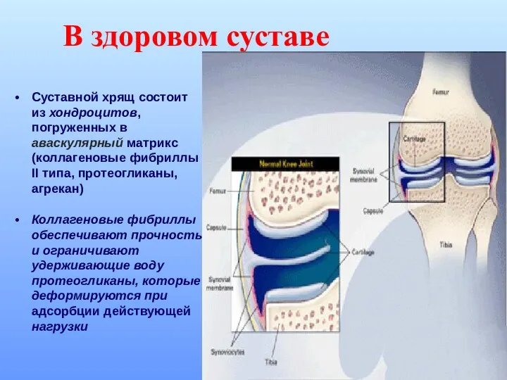 В здоровом суставе Суставной хрящ состоит из хондроцитов, погруженных в