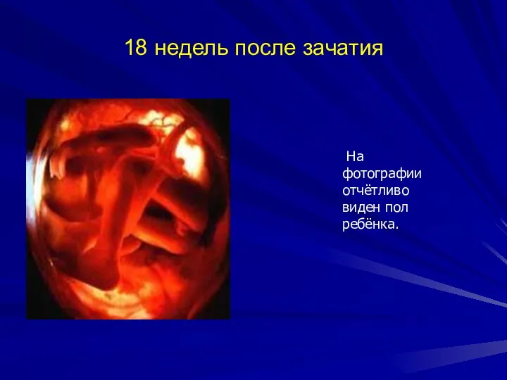 18 недель после зачатия