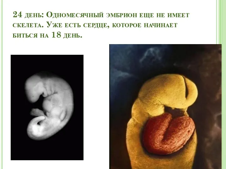 24 день: Одномесячный эмбрион еще не имеет скелета. Уже есть