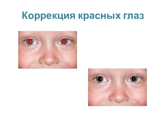Коррекция красных глаз