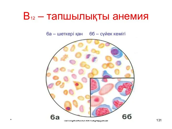 * патофизиология кафедрасы В12 – тапшылықты анемия 6а – шеткері қан 6б – сүйек кемігі