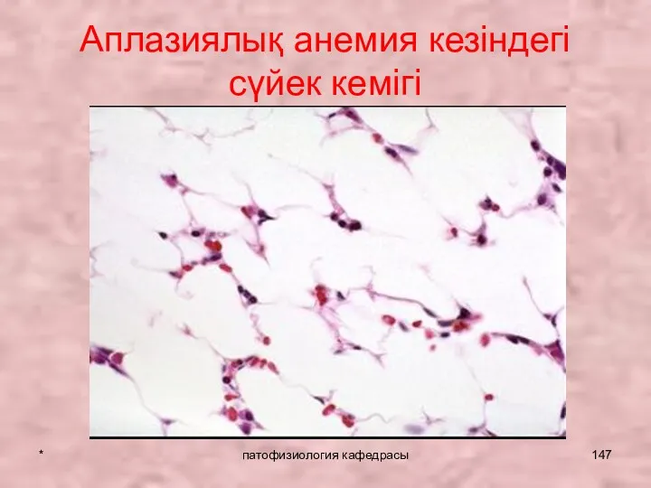 * патофизиология кафедрасы Аплазиялық анемия кезіндегі сүйек кемігі