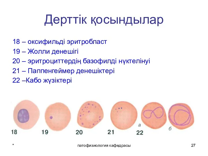 * патофизиология кафедрасы Дерттік қосындылар 18 – оксифильді эритробласт 19 – Жолли денешігі