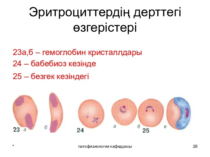 * патофизиология кафедрасы Эритроциттердің дерттегі өзгерістері 23а,б – гемоглобин кристаллдары 24 – бабебиоз