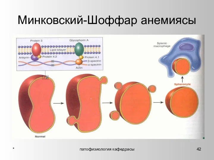 * патофизиология кафедрасы Минковский-Шоффар анемиясы