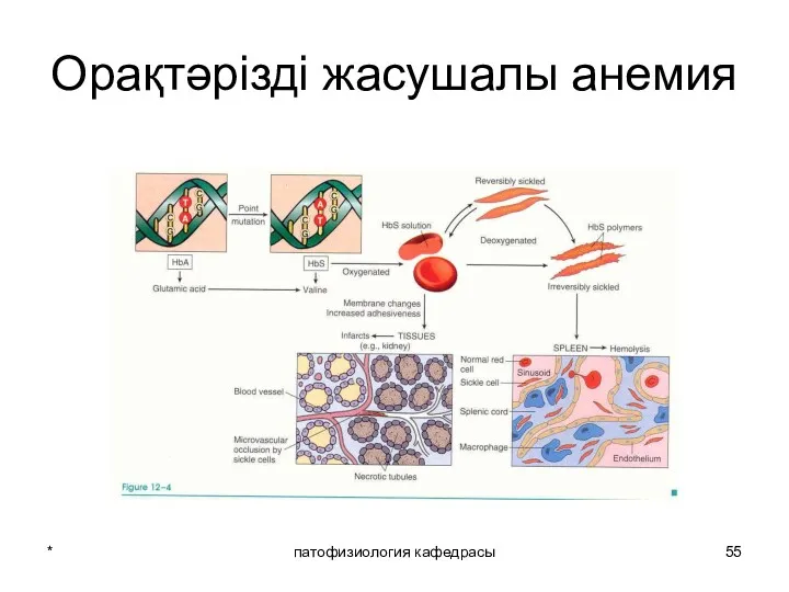 * патофизиология кафедрасы Орақтәрізді жасушалы анемия