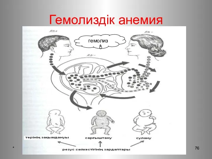 * патофизиология кафедрасы Гемолиздік анемия гемолиз