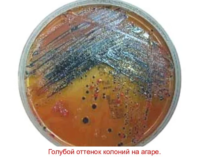 Голубой оттенок колоний на агаре.