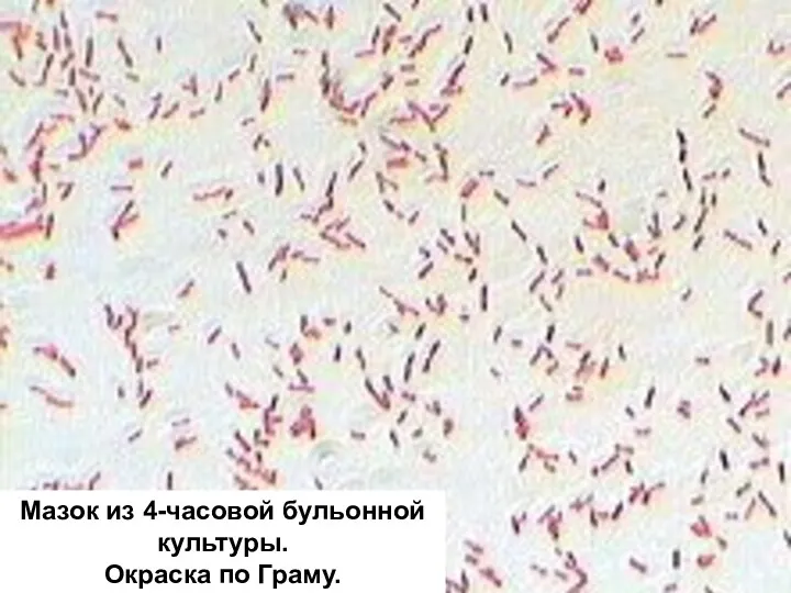 Мазок из 4-часовой бульонной культуры. Окраска по Граму.