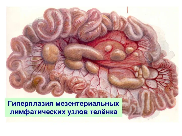 Гиперплазия мезентериальных лимфатических узлов телёнка