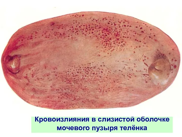 Кровоизлияния в слизистой оболочке мочевого пузыря телёнка
