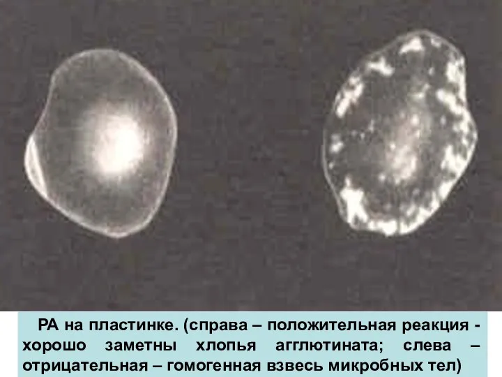 РА на пластинке. (справа – положительная реакция - хорошо заметны