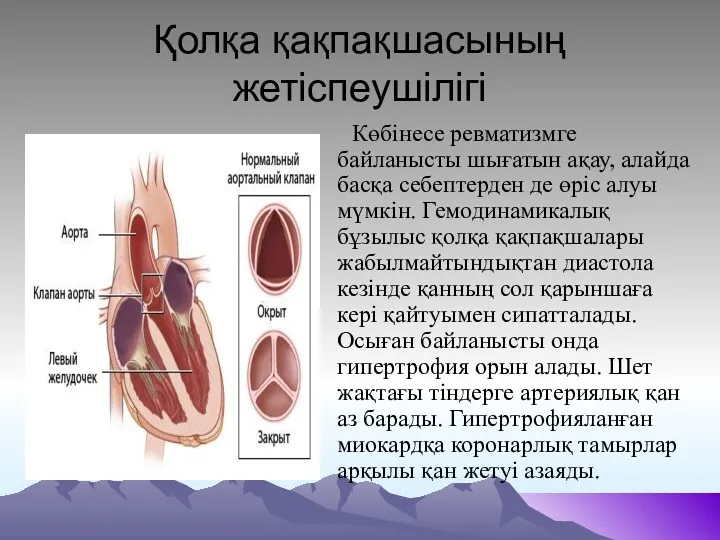 Қолқа қақпақшасының жетіспеушілігі Көбінесе ревматизмге байланысты шығатын ақау, алайда басқа