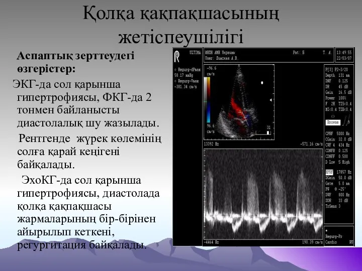 Қолқа қақпақшасының жетіспеушілігі Аспаптық зерттеудегі өзгерістер: ЭКГ-да сол қарынша гипертрофиясы,