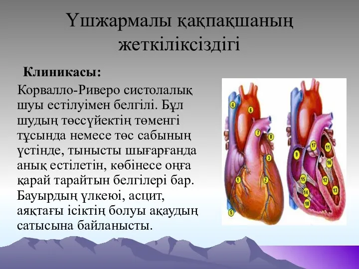 Үшжармалы қақпақшаның жеткіліксіздігі Клиникасы: Корвалло-Риверо систолалық шуы естілуімен белгілі. Бұл