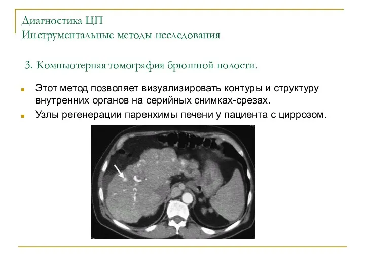 Диагностика ЦП Инструментальные методы исследования 3. Компьютерная томография брюшной полости.