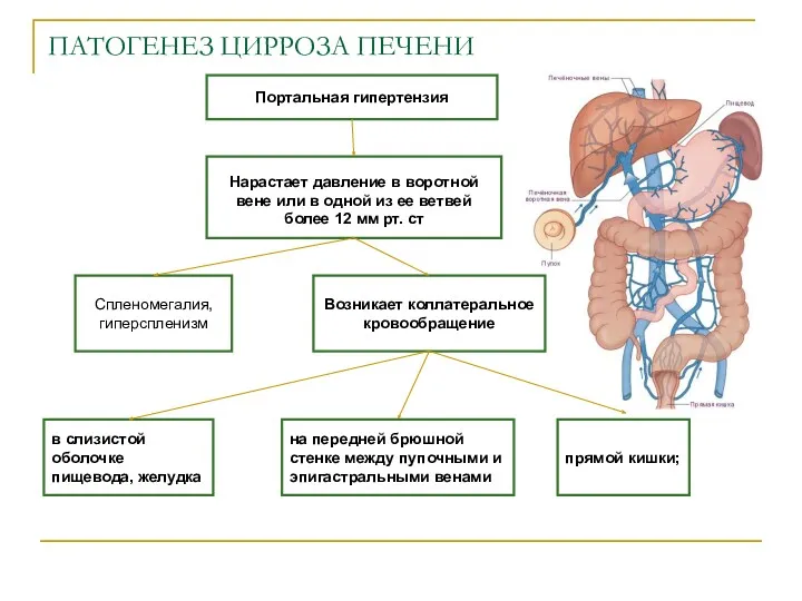 ПАТОГЕНЕЗ ЦИРРОЗА ПЕЧЕНИ Портальная гипертензия Нарастает давление в воротной вене