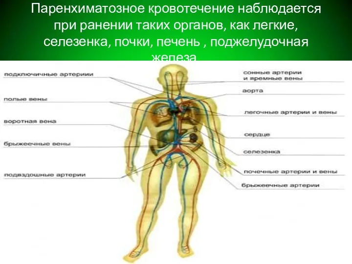 Паренхиматозное кровотечение наблюдается при ранении таких органов, как легкие, селезенка, почки, печень , поджелудочная железа.