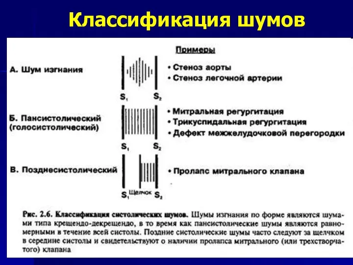 Классификация шумов