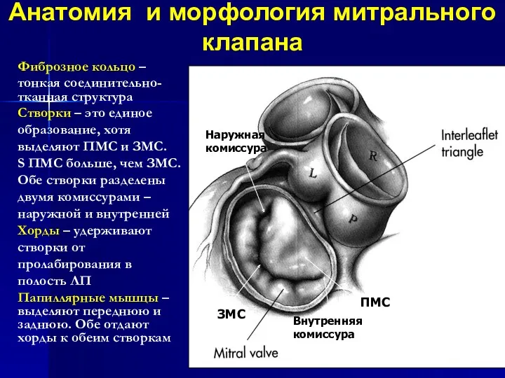 Анатомия и морфология митрального клапана Наружная комиссура Внутренняя комиссура ЗМС