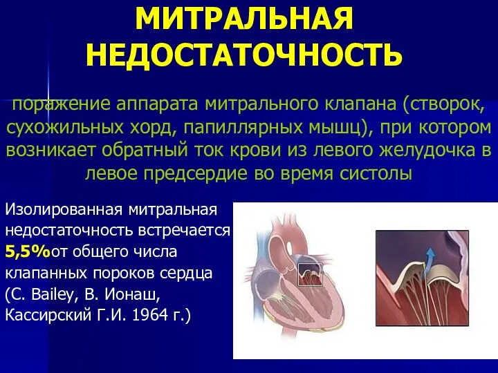 МИТРАЛЬНАЯ НЕДОСТАТОЧНОСТЬ Изолированная митральная недостаточность встречается в 5,5%от общего числа