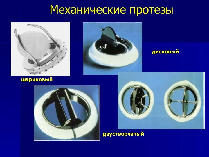 Механические протезы шариковый дисковый двустворчатый