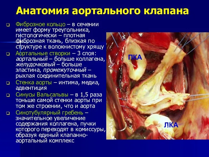 Анатомия аортального клапана Фиброзное кольцо – в сечении имеет форму