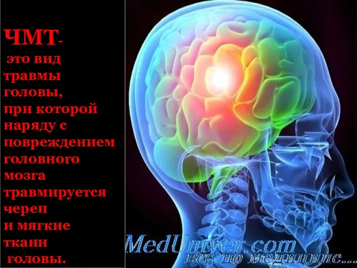 ЧМТ- это вид травмы головы, при которой наряду с повреждением