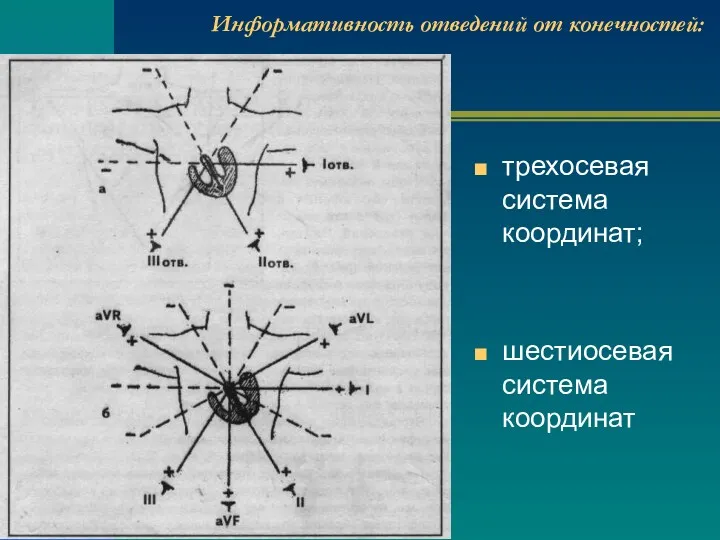 Информативность отведений от конечностей: трехосевая система координат; шестиосевая система координат