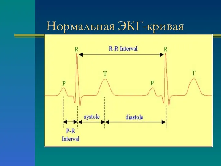 Нормальная ЭКГ-кривая