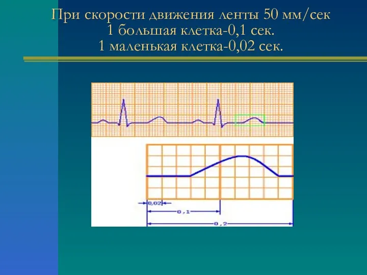 При скорости движения ленты 50 мм/сек 1 большая клетка-0,1 сек. 1 маленькая клетка-0,02 сек.