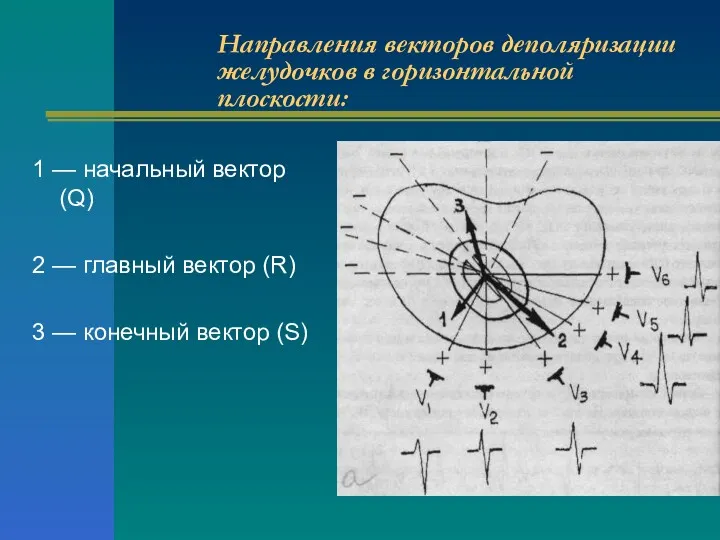 Направления векторов деполяризации желудочков в горизонтальной плоскости: 1 — начальный