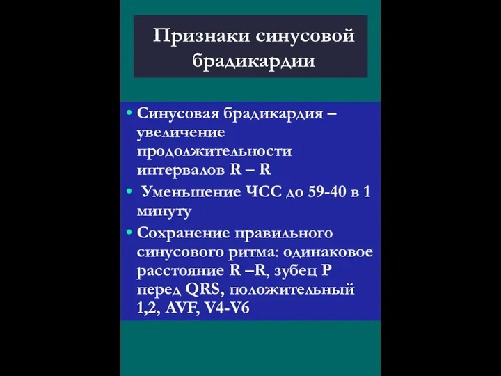 Признаки синусовой брадикардии Синусовая брадикардия – увеличение продолжительности интервалов R