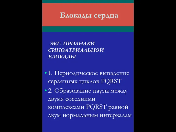 Блокады сердца ЭКГ- ПРИЗНАКИ СИНОАТРИАЛЬНОЙ БЛОКАДЫ 1. Периодическое выпадение сердечных