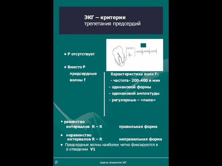 ЭКГ – критерии трепетания предсердий Р отсутствует Вместо Р предсердные