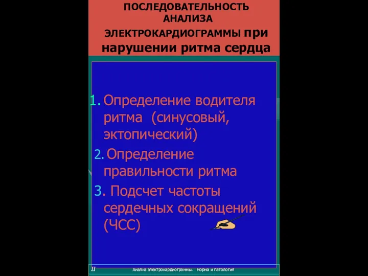 ПОСЛЕДОВАТЕЛЬНОСТЬ АНАЛИЗА ЭЛЕКТРОКАРДИОГРАММЫ при нарушении ритма сердца Определение водителя ритма