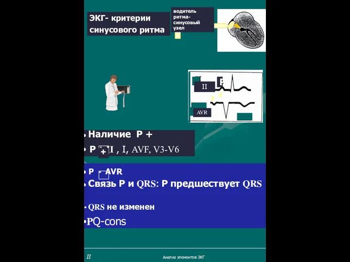 ЭКГ- критерии синусового ритма Р II AVR водитель ритма- синусовый узел II Анализ элементов ЭКГ