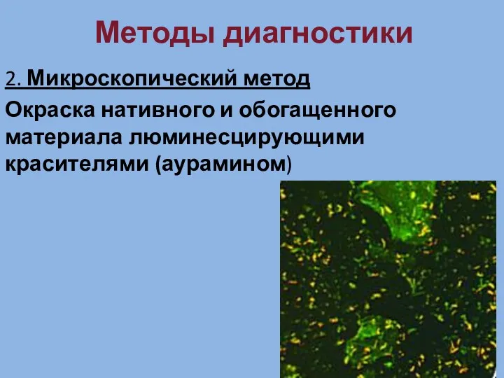 Методы диагностики 2. Микроскопический метод Окраска нативного и обогащенного материала люминесцирующими красителями (аурамином)