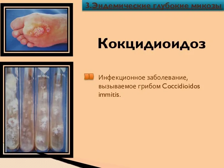 Кокцидиоидоз Инфекционное заболевание, вызываемое грибом Coccidioidos immitis. 3.Эндемические глубокие микозы