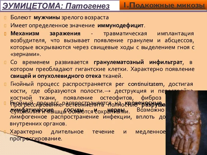 ЭУМИЦЕТОМА: Патогенез 1.Подкожные микозы Гнойный процесс распространяется на кровеносные, лимфатические