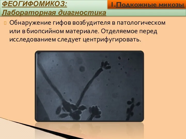 ФЕОГИФОМИКОЗ: Лабораторная диагностика Обнаружение гифов возбудителя в патологическом или в