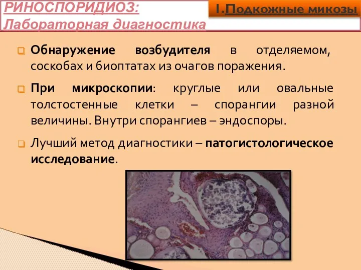 РИНОСПОРИДИОЗ: Лабораторная диагностика Обнаружение возбудителя в отделяемом, соскобах и биоптатах