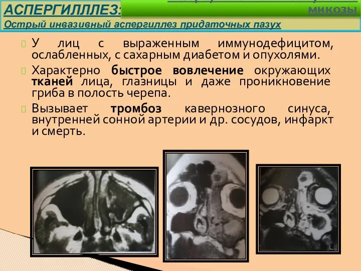 У лиц с выраженным иммунодефицитом, ослабленных, с сахарным диабетом и