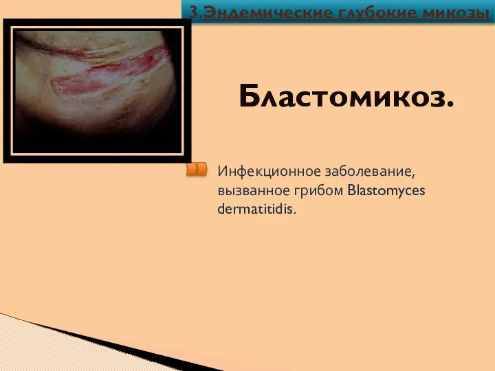 Бластомикоз. Инфекционное заболевание, вызванное грибом Blastomyces dermatitidis. 3.Эндемические глубокие микозы