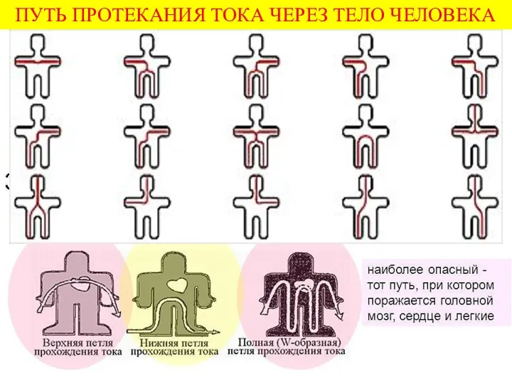 ПУТЬ ПРОТЕКАНИЯ ТОКА ЧЕРЕЗ ТЕЛО ЧЕЛОВЕКА