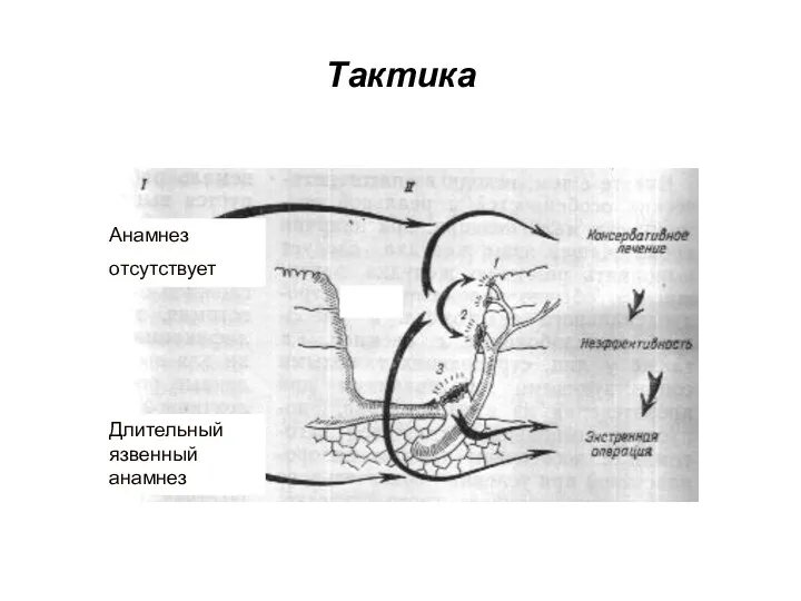 Тактика Анамнез отсутствует Длительный язвенный анамнез