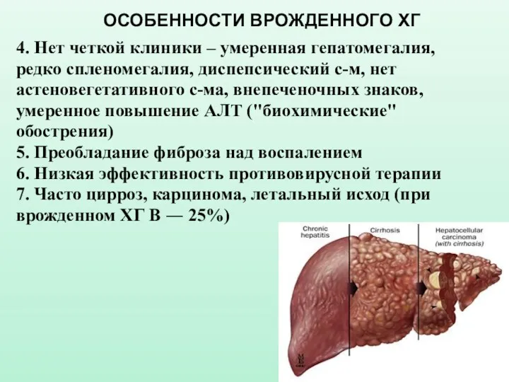 ОСОБЕННОСТИ ВРОЖДЕННОГО ХГ 4. Нет четкой клиники – умеренная гепатомегалия,