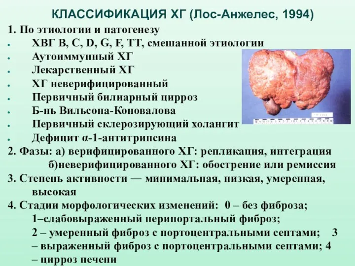 КЛАССИФИКАЦИЯ ХГ (Лос-Анжелес, 1994) 1. По этиологии и патогенезу ХВГ